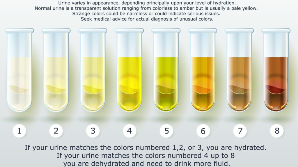 1 Week Pregnancy Urine Color Chart How Healthy Are You Here 39 s What 