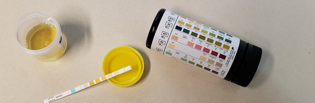 1 Week Pregnancy Urine Color Chart How Healthy Are You Here 39 s What 