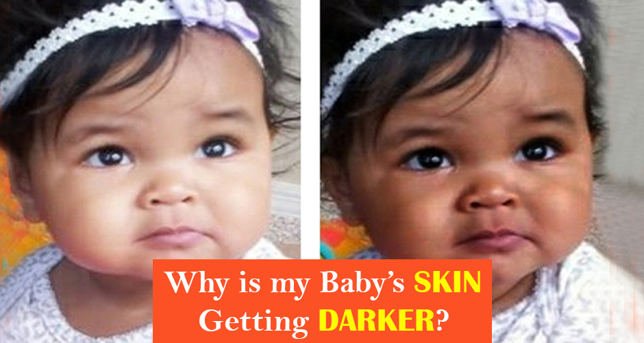 Baby Skin Color Chart A Visual Reference Of Charts Chart Master