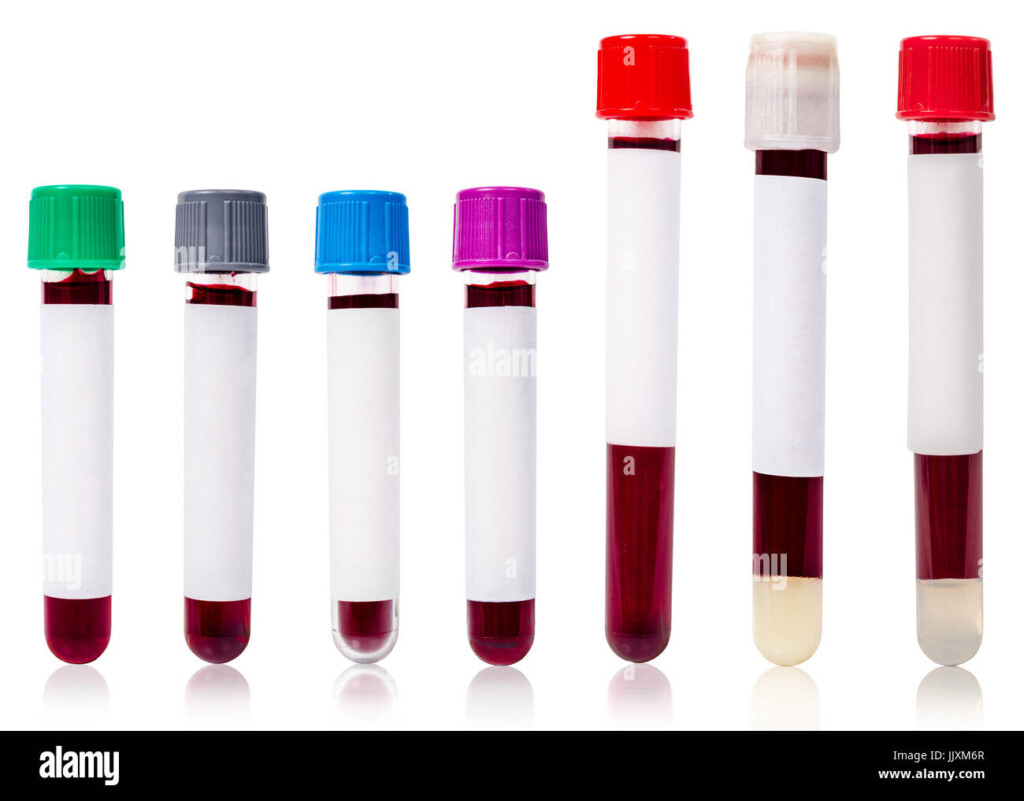 Blood Tube Color Chart