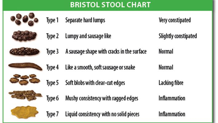 Colonoscopy Prep Color Chart