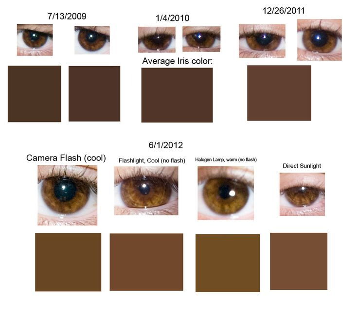 Dark Brown Eyes Shades Of Brown Eyes Eye Color Chart