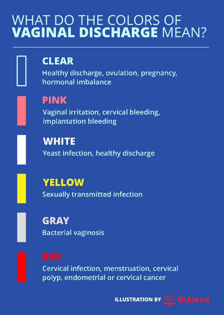 Discharge Color Chart Discharge Color Chart