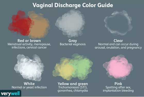 Discharge Color Chart Discharge Color Chart