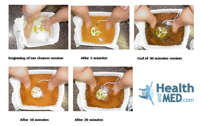 Foot Detox Color Chart Meaning