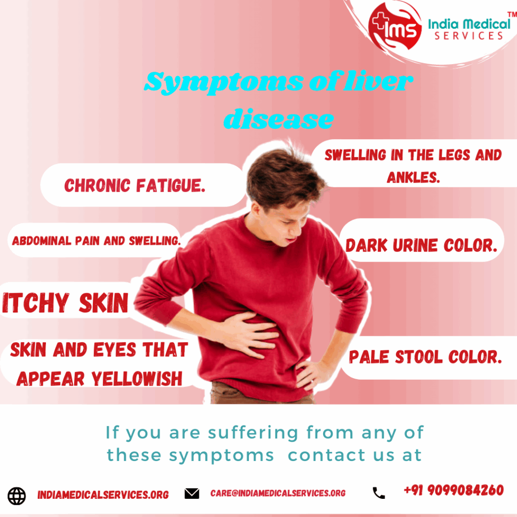 Liver Disease Urine Color Order Sales Www olganossova