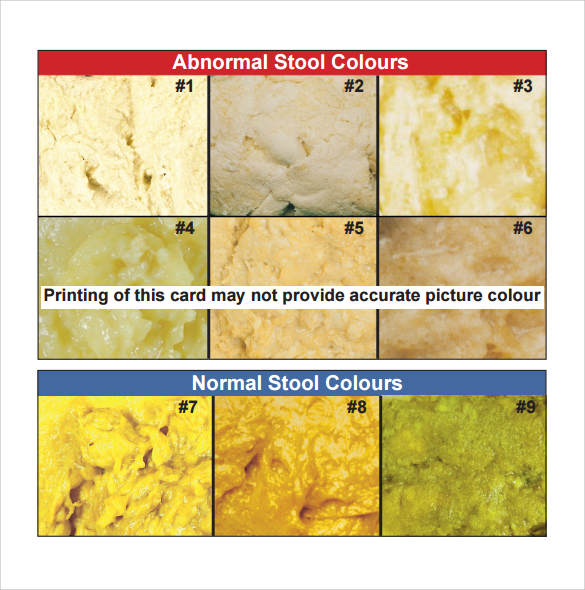 Medical Stool Color Chart