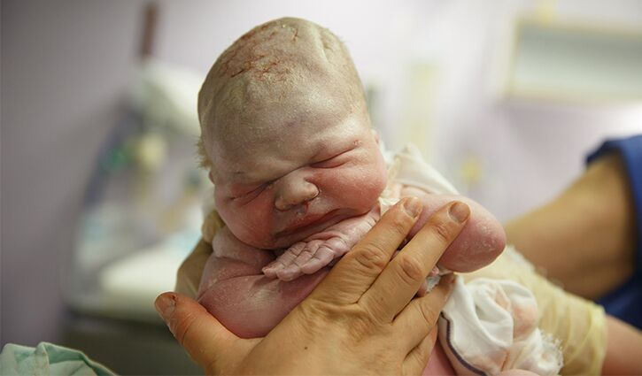 Newborn Skin What s Normal Newborn Baby
