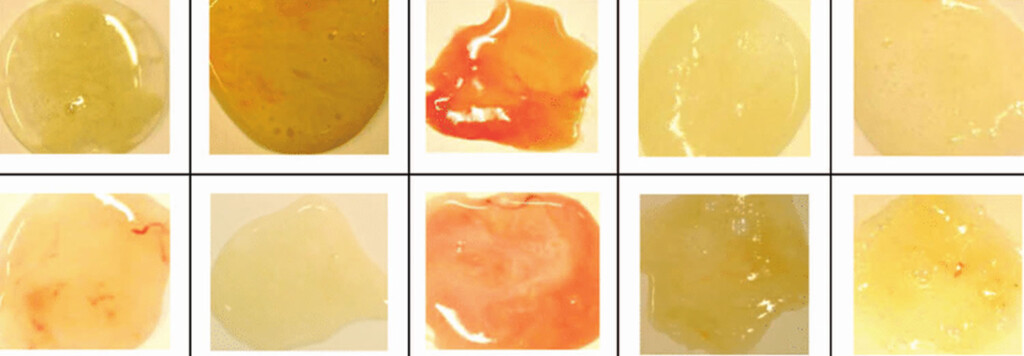 Phlegm Color Chart Google Search Mucus Color Chart Mucus Color Mucus 
