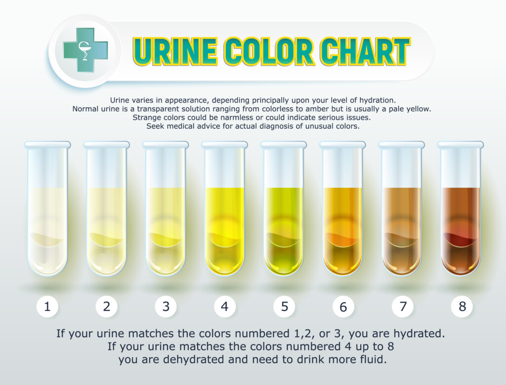Pin On Prevention Urine Colors Chart Medications And Food Can Change 