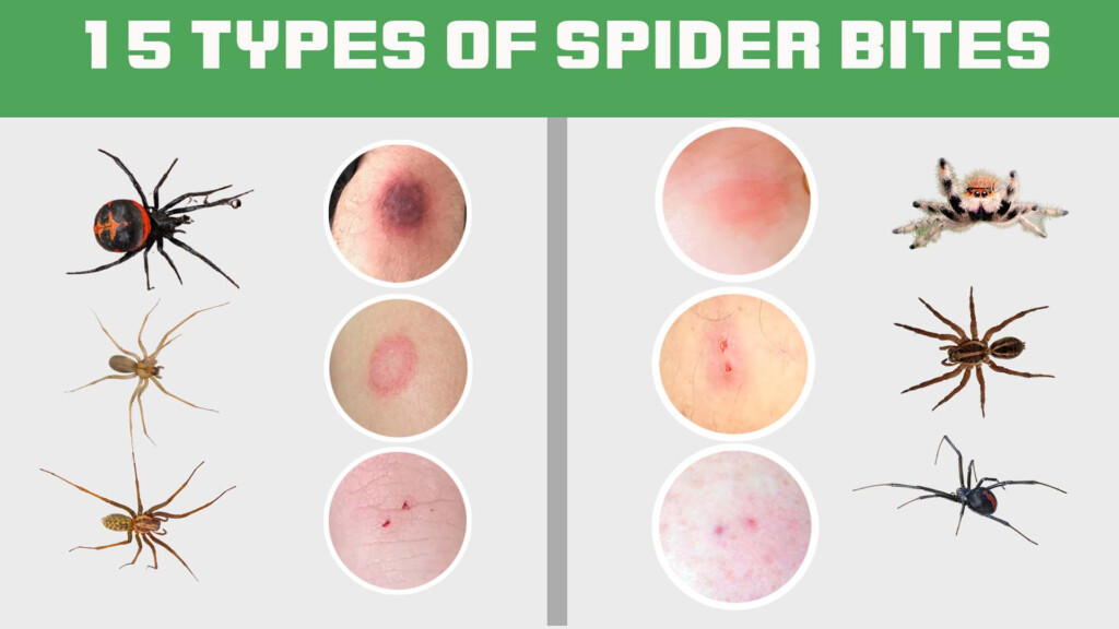 Spider Bite Identification NBKomputer