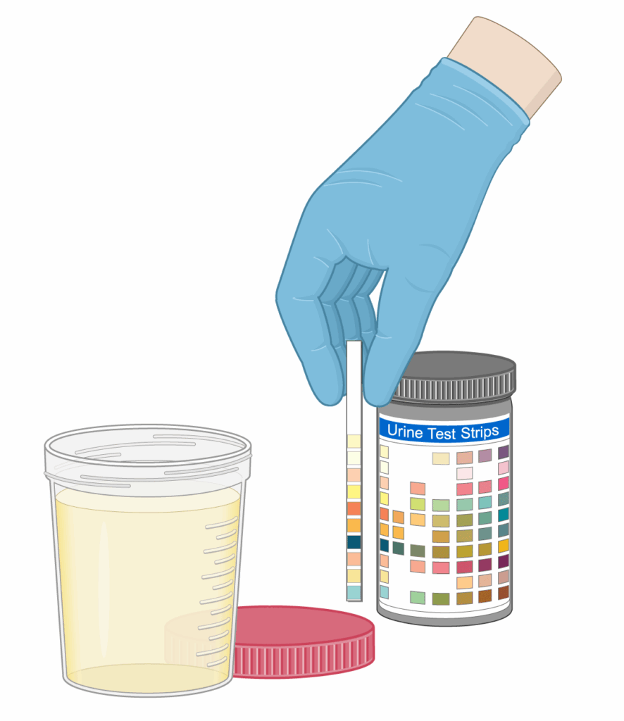 Urinalysis Lab Simulation Human Bio Media