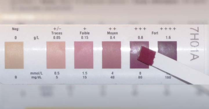 Urinalysis Test Strip Color Chart Learnparallaxcom Medical Lab Pin On 