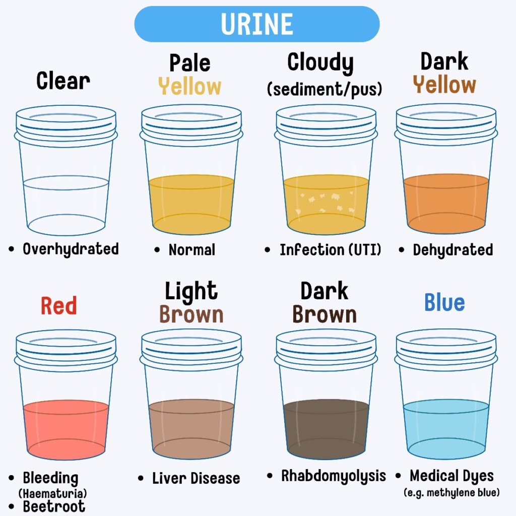 Urine Color Chart Healthy Colors And When To Seek Help Artofit