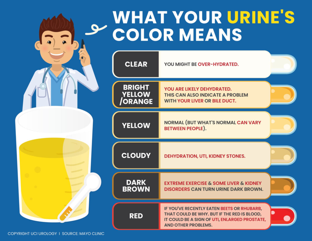 Urine Color Chart Meaning Urine Color Chart What s Normal And When To 