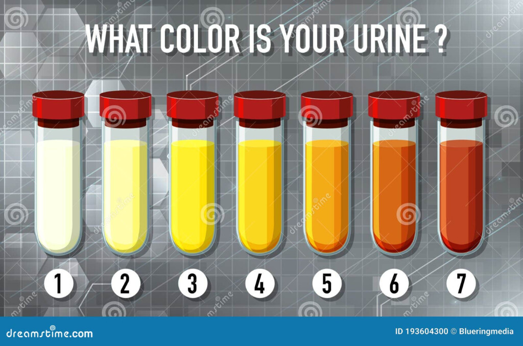 Urine Color Chart Urine Color Chart Clear Youve Been Drinking Too 