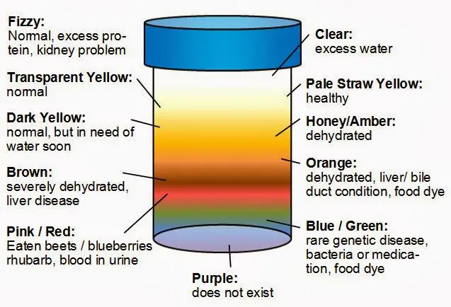 Urine Color Meaning Red Brown Orange Black Purple Etc 