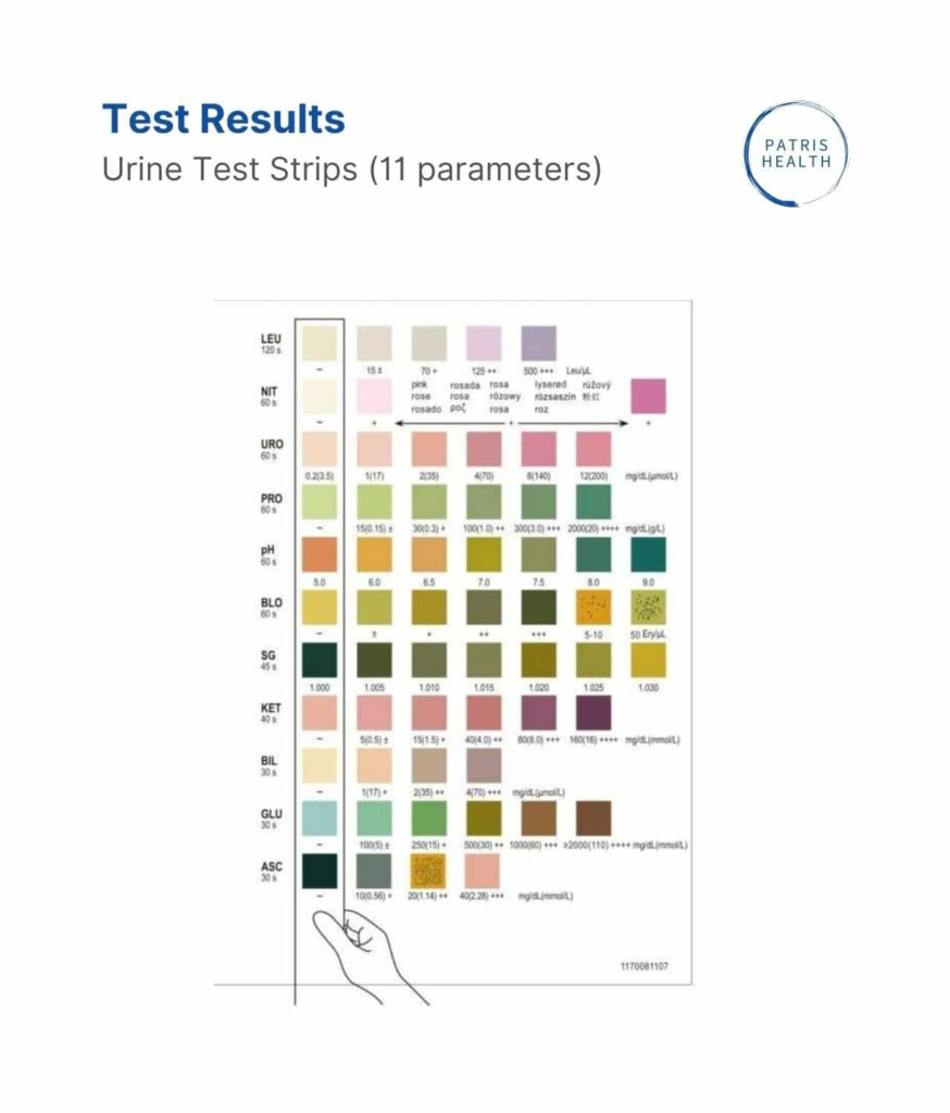 Urine Strip Urinalysis Test Strip Color Chart Learnparallaxcom 