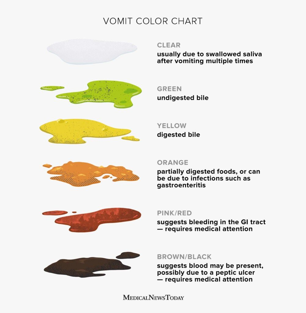 Vomit Color Chart Clear White Green Yellow Orange Red And More 