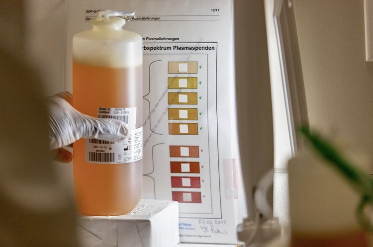 Why Blood Plasma Isn t Always Yellow